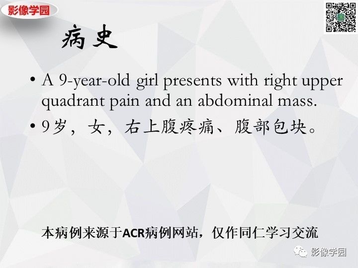 【病例】左肝恶性神经内分泌肿瘤1例CT