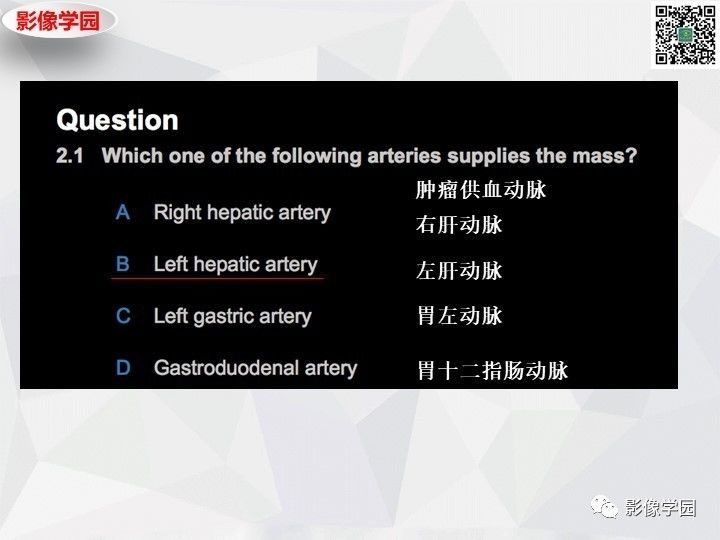 【病例】左肝恶性神经内分泌肿瘤1例CT