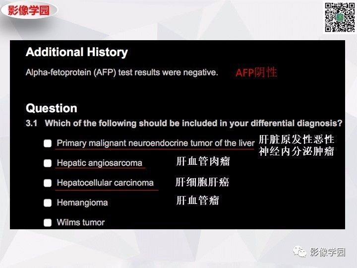【病例】左肝恶性神经内分泌肿瘤1例CT