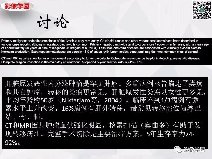 【病例】左肝恶性神经内分泌肿瘤1例CT