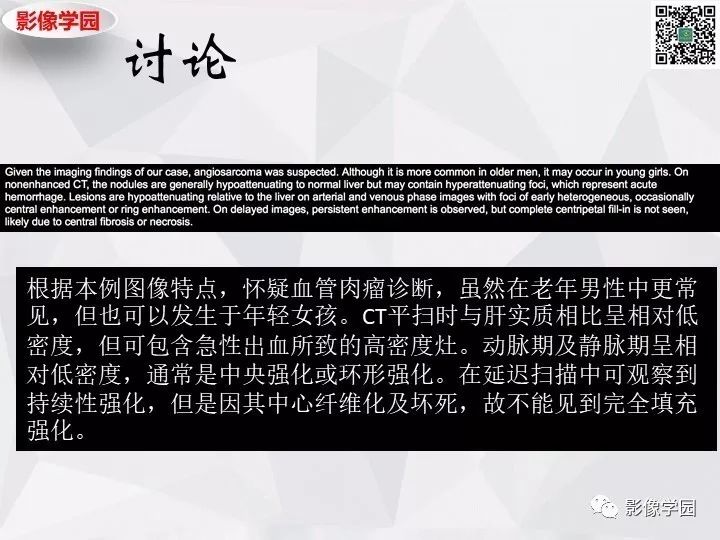 【病例】左肝恶性神经内分泌肿瘤1例CT