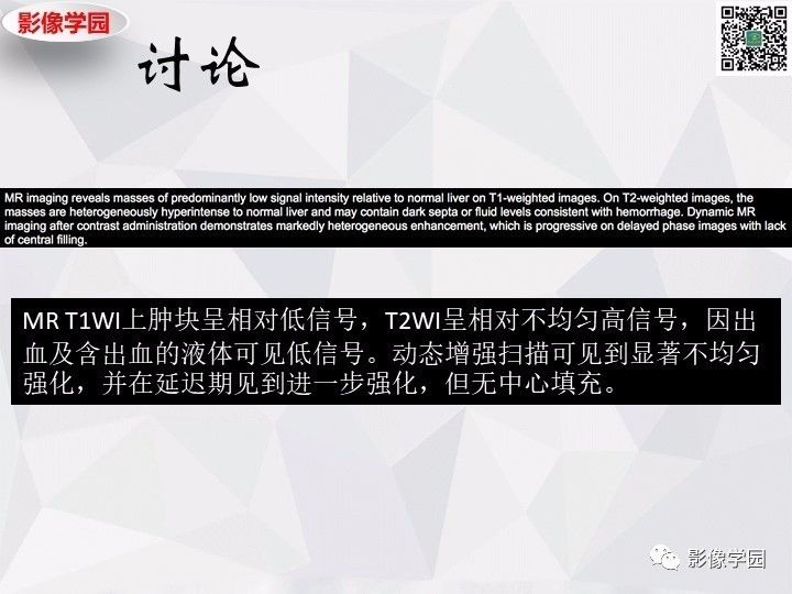 【病例】左肝恶性神经内分泌肿瘤1例CT