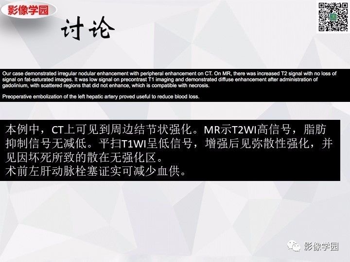 【病例】左肝恶性神经内分泌肿瘤1例CT