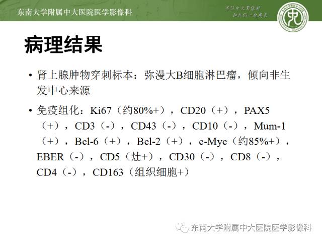 【病例】原发性肾上腺淋巴瘤1例CT影像表现