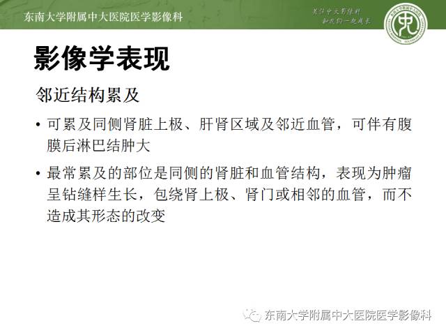 【病例】原发性肾上腺淋巴瘤1例CT影像表现