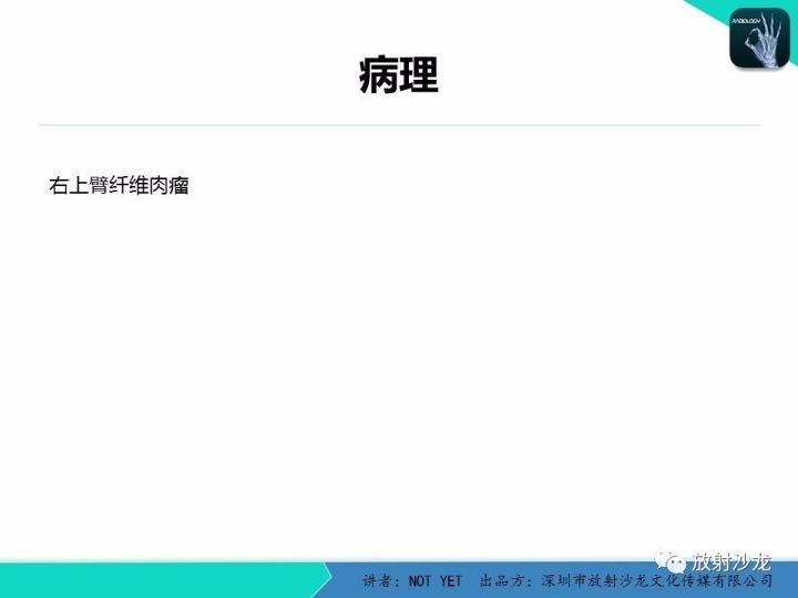 【病例】左上臂纤维肉瘤1例MR
