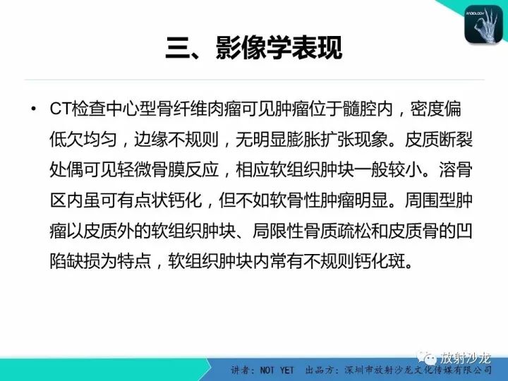 【病例】左上臂纤维肉瘤1例MR