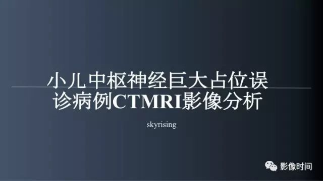 【误诊病例】鞍区巨大血管畸形1例CT及MR