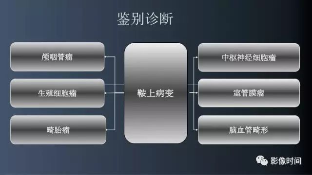 【误诊病例】鞍区巨大血管畸形1例CT及MR