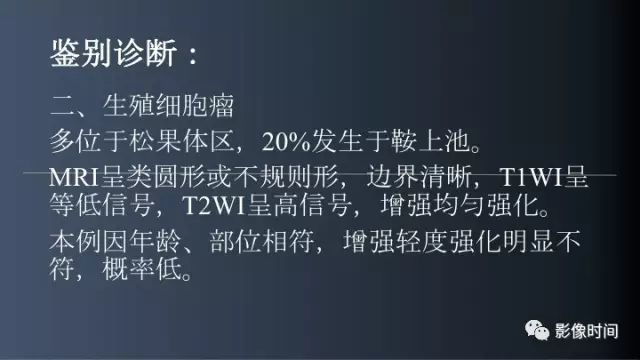 【误诊病例】鞍区巨大血管畸形1例CT及MR