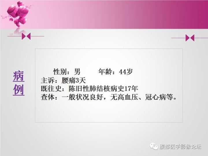 【病例】肾上腺髓质脂肪瘤1例CT及MR诊断与鉴别诊断