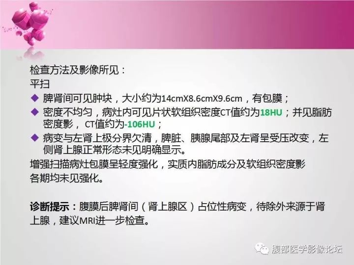 【病例】肾上腺髓质脂肪瘤1例CT及MR诊断与鉴别诊断