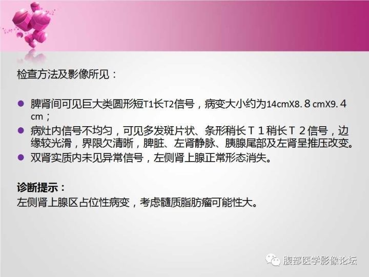 【病例】肾上腺髓质脂肪瘤1例CT及MR诊断与鉴别诊断