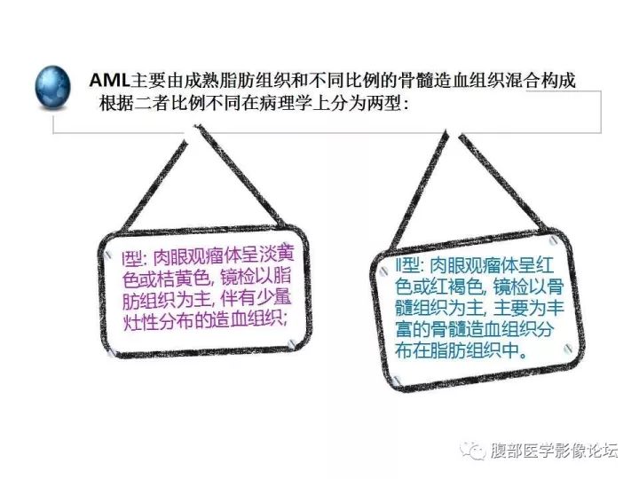 【病例】肾上腺髓质脂肪瘤1例CT及MR诊断与鉴别诊断