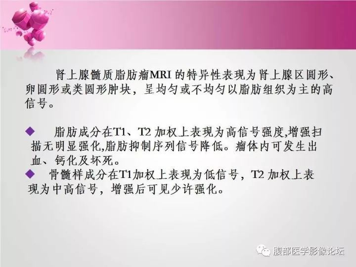 【病例】肾上腺髓质脂肪瘤1例CT及MR诊断与鉴别诊断