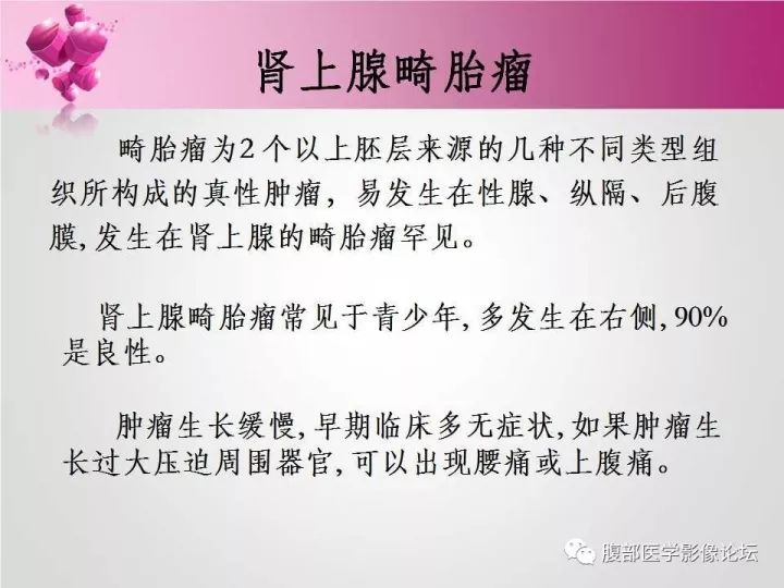 【病例】肾上腺髓质脂肪瘤1例CT及MR诊断与鉴别诊断