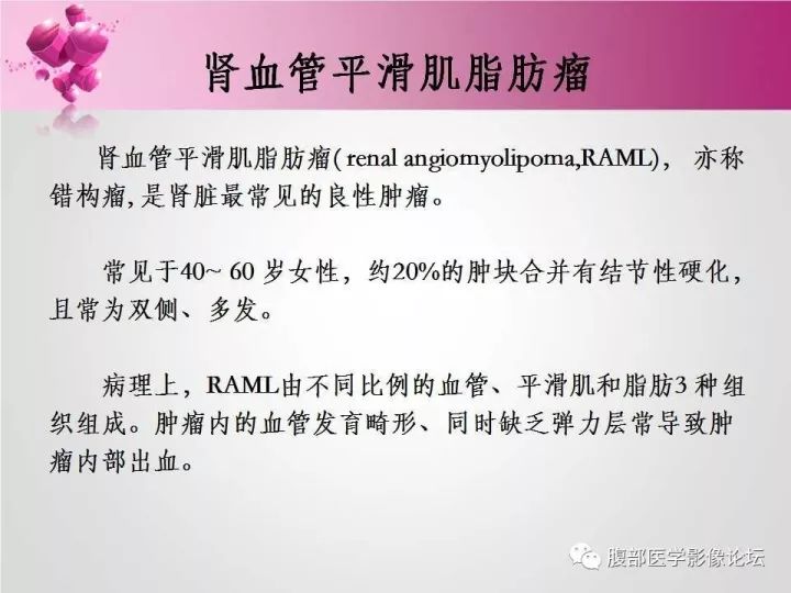 【病例】肾上腺髓质脂肪瘤1例CT及MR诊断与鉴别诊断