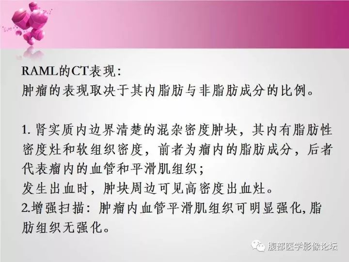 【病例】肾上腺髓质脂肪瘤1例CT及MR诊断与鉴别诊断