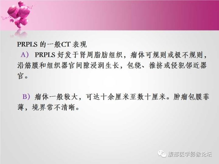 【病例】肾上腺髓质脂肪瘤1例CT及MR诊断与鉴别诊断
