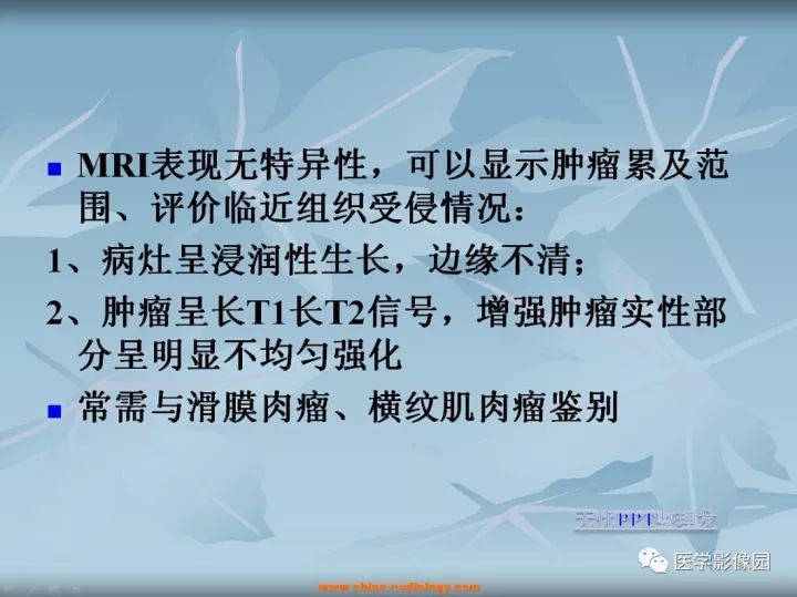 【病例】大腿纤维肉瘤1例MR