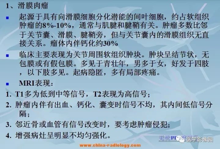 【病例】大腿纤维肉瘤1例MR