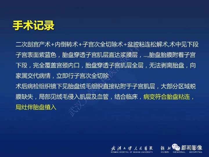 【病例】胎盘植入和前置胎盘1例MR诊断