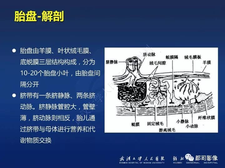 【病例】胎盘植入和前置胎盘1例MR诊断
