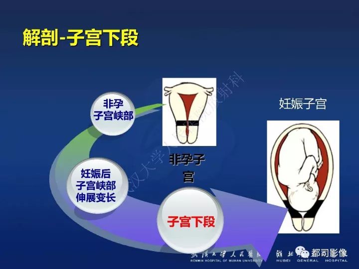 【病例】胎盘植入和前置胎盘1例MR诊断