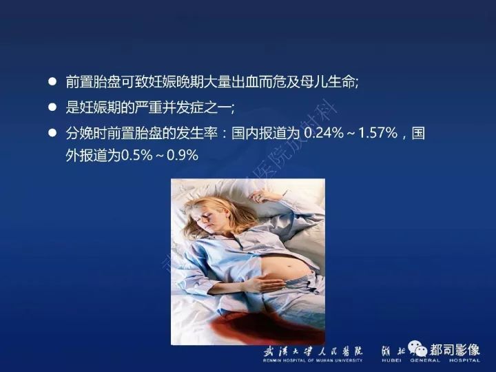 【病例】胎盘植入和前置胎盘1例MR诊断