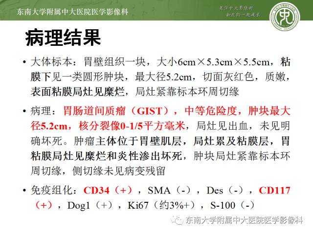 【病例】胃间质瘤1例CT影像表现