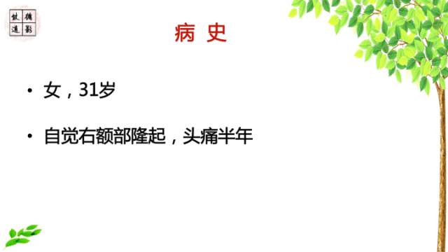 【病例】额骨骨纤维结构不良1例CT及MR