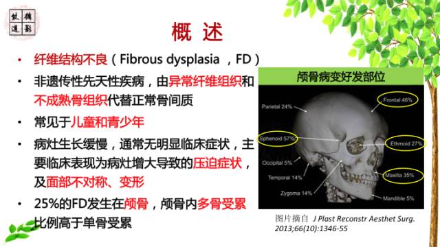 【病例】额骨骨纤维结构不良1例CT及MR