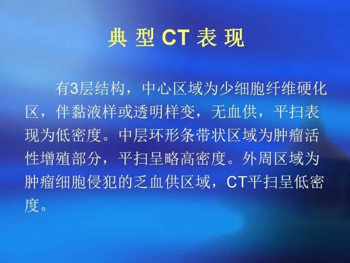【病例】肝脏上皮样血管内皮瘤VS肝脏血管周上皮样血管瘤