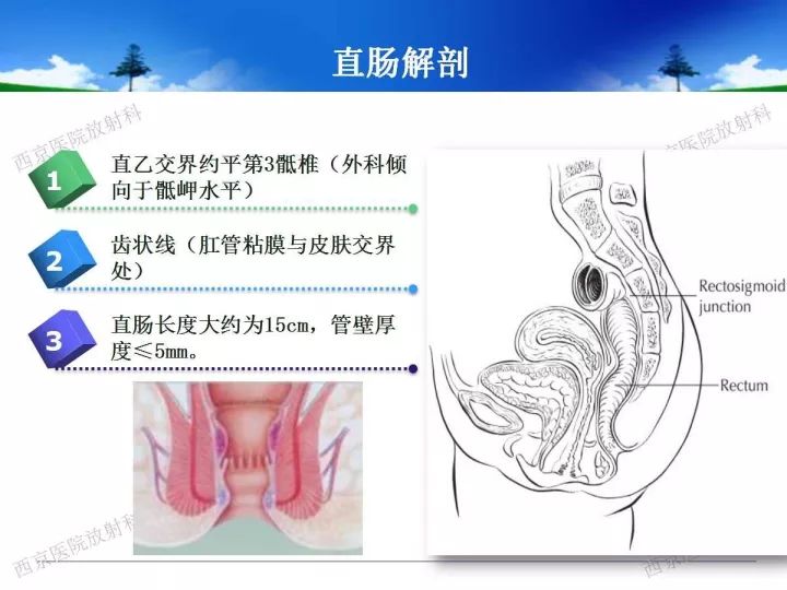 【PPT】直肠癌MRI诊断