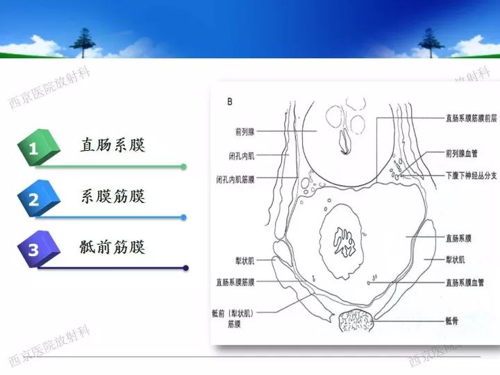 【PPT】直肠癌MRI诊断