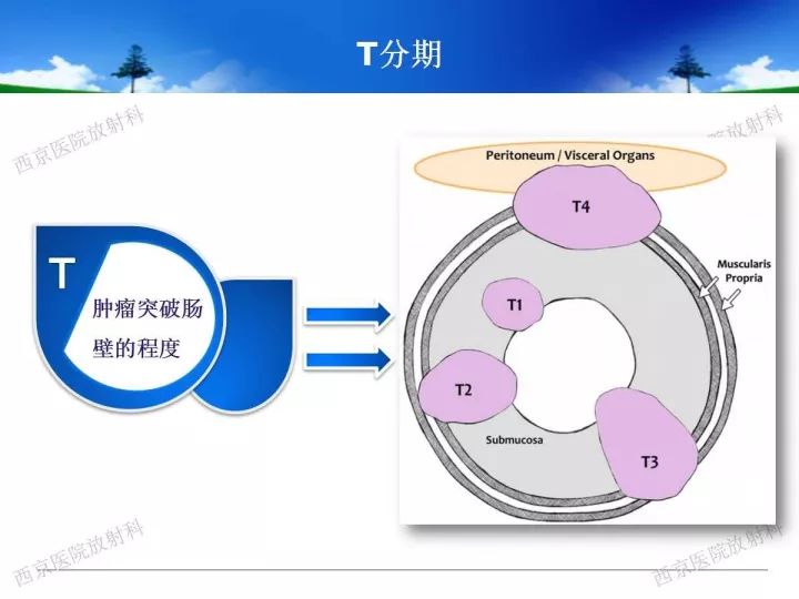 【PPT】直肠癌MRI诊断