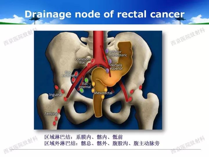 【PPT】直肠癌MRI诊断