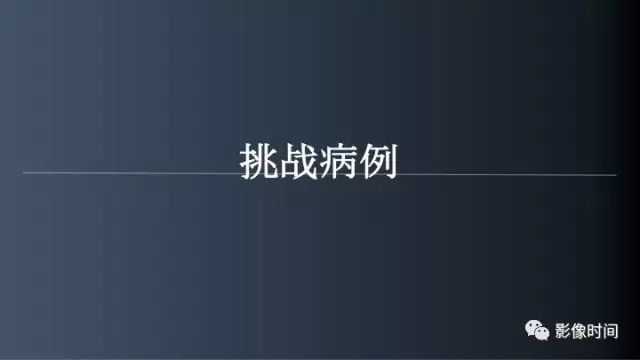 【病例】脑干实性血管母细胞瘤1例MR