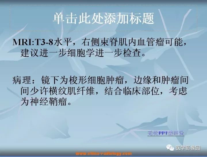 【病例】右侧背部神经鞘瘤1例MR