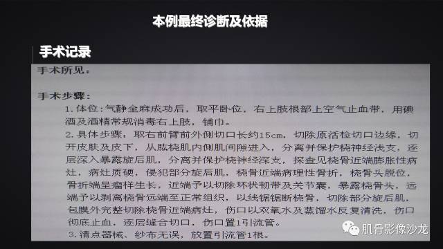 【病例】骨化性纤维瘤两例影像讨论 【病例】骨化性纤维瘤两例影像讨论