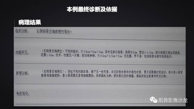 【病例】骨化性纤维瘤两例影像讨论 【病例】骨化性纤维瘤两例影像讨论