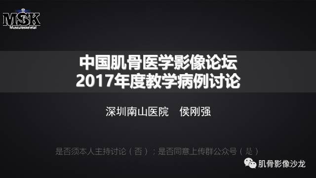 【病例】骨化性纤维瘤两例影像讨论 【病例】骨化性纤维瘤两例影像讨论