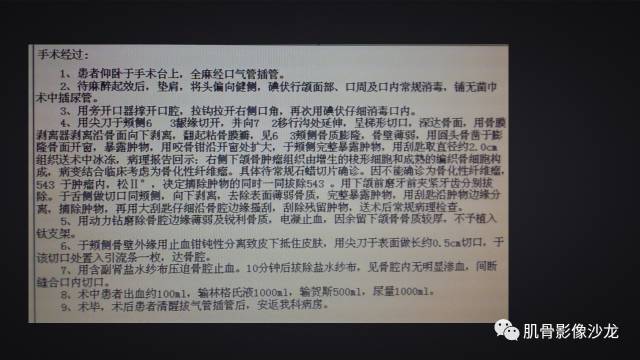 【病例】骨化性纤维瘤两例影像讨论 【病例】骨化性纤维瘤两例影像讨论