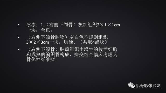 【病例】骨化性纤维瘤两例影像讨论 【病例】骨化性纤维瘤两例影像讨论