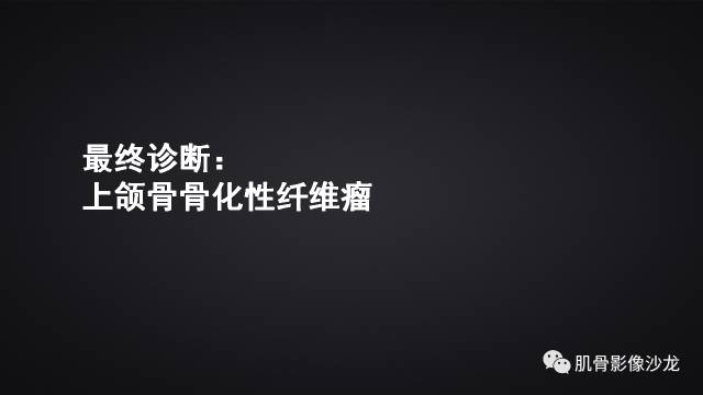 【病例】骨化性纤维瘤两例影像讨论 【病例】骨化性纤维瘤两例影像讨论