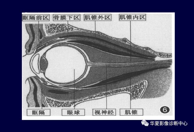 【PPT】常见眼眶内肿瘤的影像诊断分析