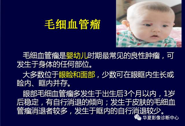 【PPT】常见眼眶内肿瘤的影像诊断分析