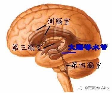 第五、第六脑室属于脑室系统吗？