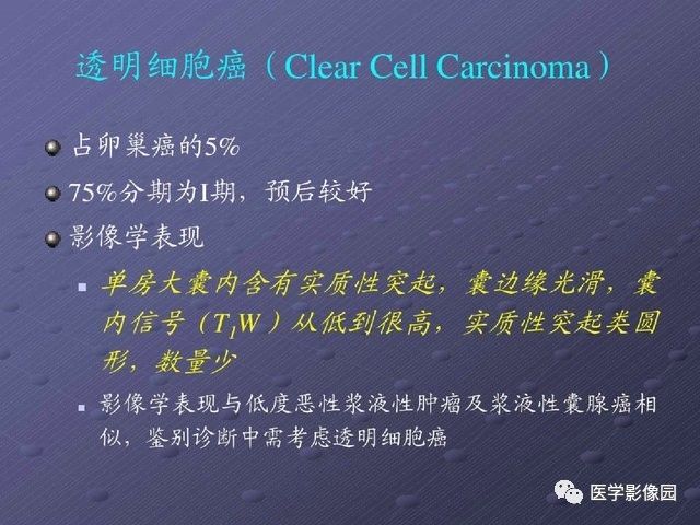 【PPT】卵巢肿瘤CT影像诊断