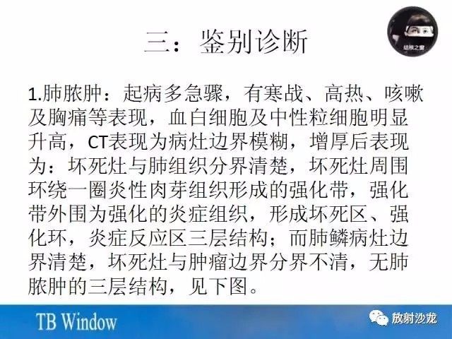 【PPT】周围型肺鳞癌的影像征象及鉴别诊断